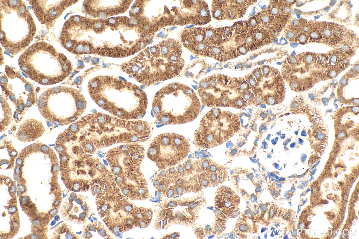 IHC staining of mouse kidney using 26653-1-AP (same clone as 26653-1-PBS) IHC staining of mouse kidney using 26653-1-AP (same clone as 26653-1-PBS)
