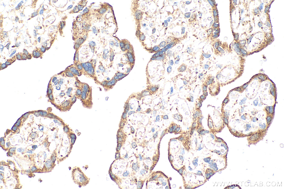 IHC staining of human placenta using 26653-1-AP (same clone as 26653-1-PBS) IHC staining of human placenta using 26653-1-AP (same clone as 26653-1-PBS)