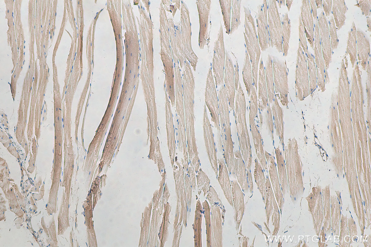 IHC staining of mouse skeletal muscle using 15304-1-AP
