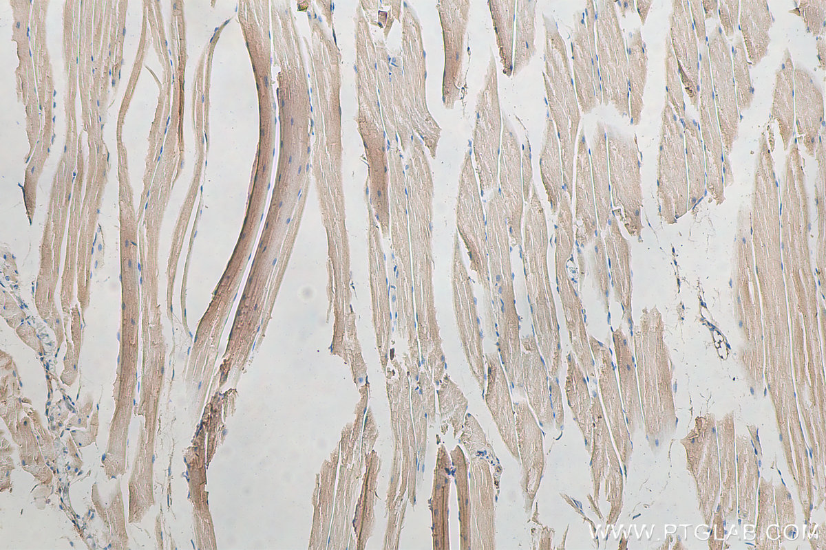IHC staining of mouse skeletal muscle using 15304-1-AP (same clone as 15304-1-PBS)