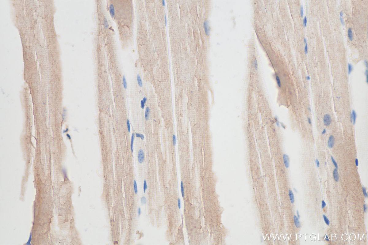 IHC staining of mouse skeletal muscle using 15304-1-AP (same clone as 15304-1-PBS)