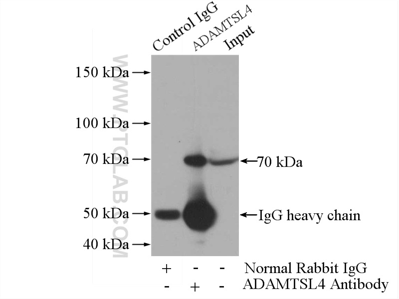 IP experiment of mouse brain using 15304-1-AP