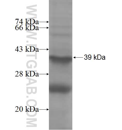 ADAMTSL4 fusion protein Ag4292 SDS-PAGE ADAMTSL4 fusion protein Ag4292 SDS-PAGE