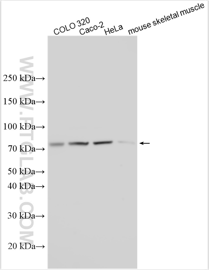WB analysis using 32965-1-AP WB analysis using 32965-1-AP
