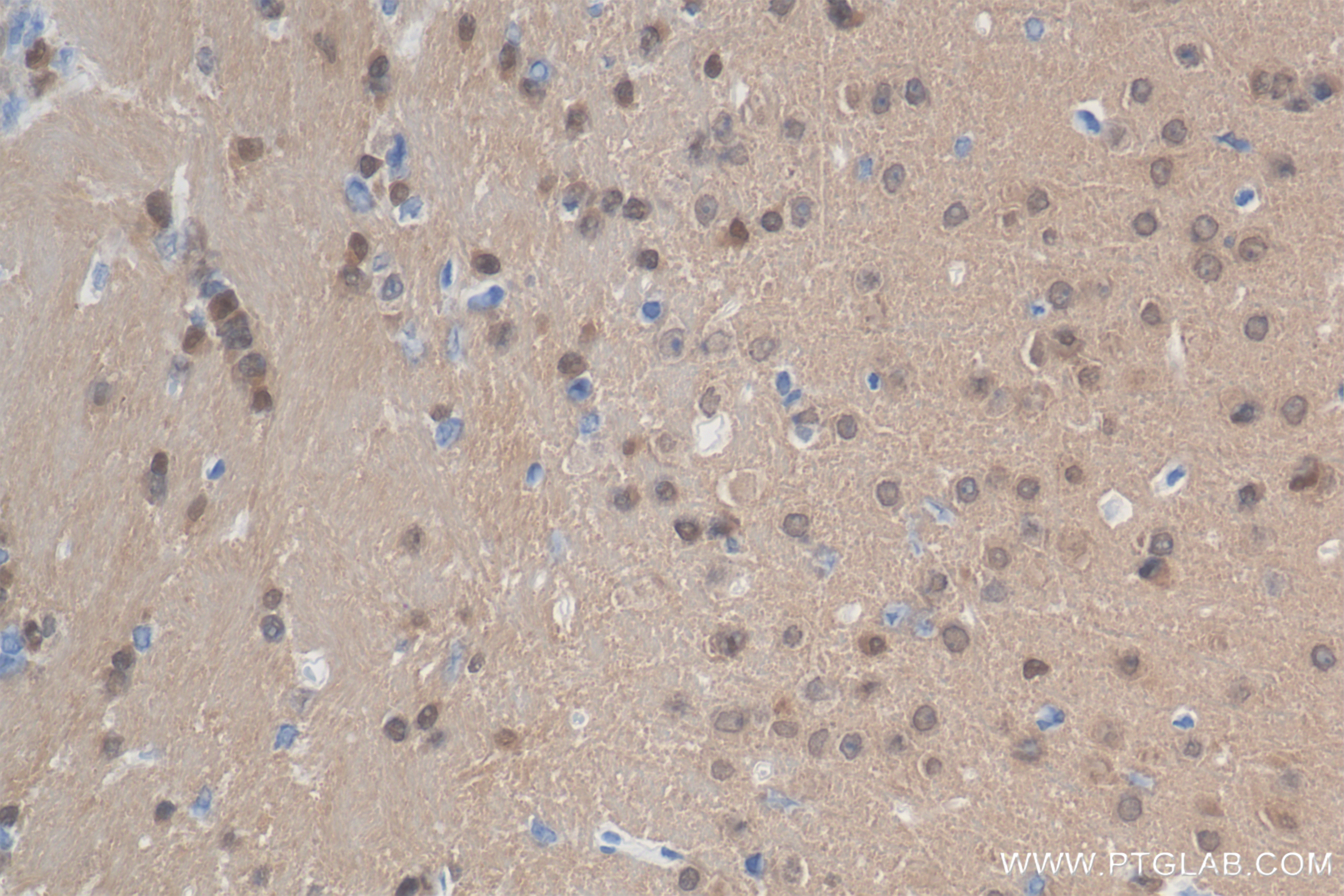 IHC staining of mouse brain using 84443-1-RR