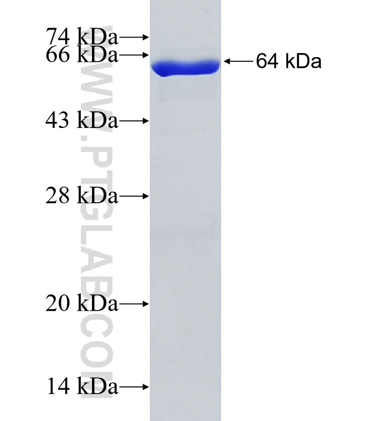 ADAP1 fusion protein Ag4898 SDS-PAGE