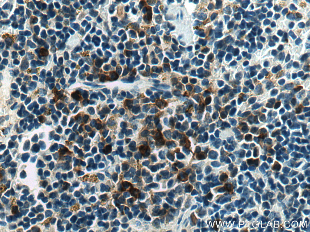 IHC staining of mouse spleen using 13706-1-AP