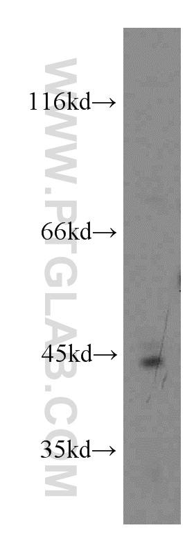 WB analysis of human placenta using 13706-1-AP