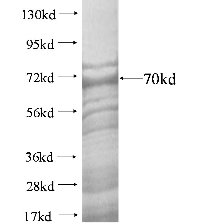 ADAP2 fusion protein Ag4326 SDS-PAGE