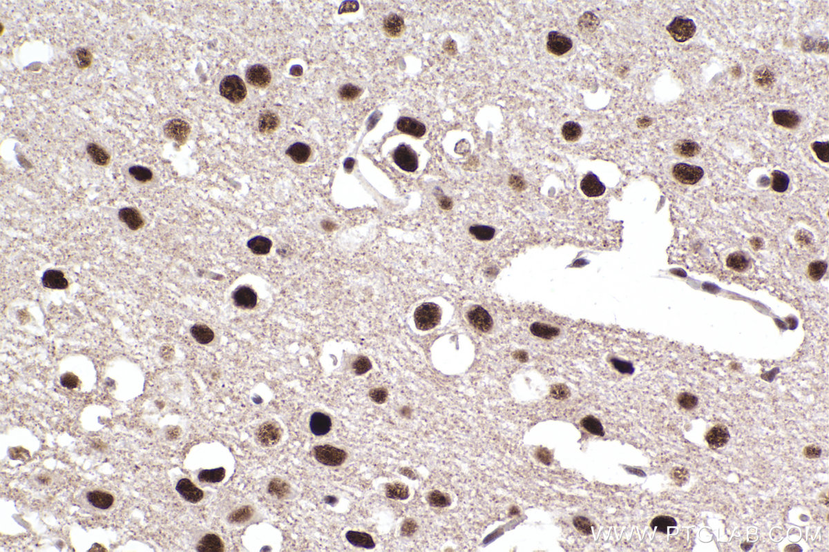 IHC staining of mouse brain using 22248-1-AP