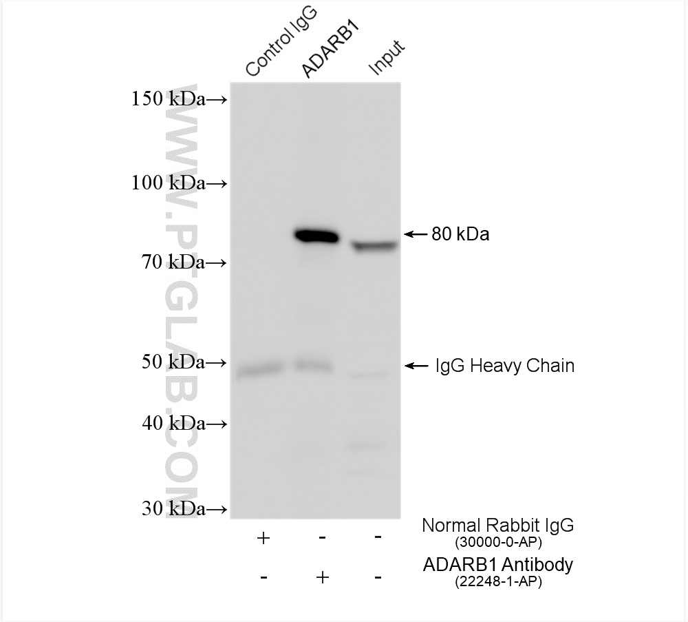 IP experiment of HeLa using 22248-1-AP