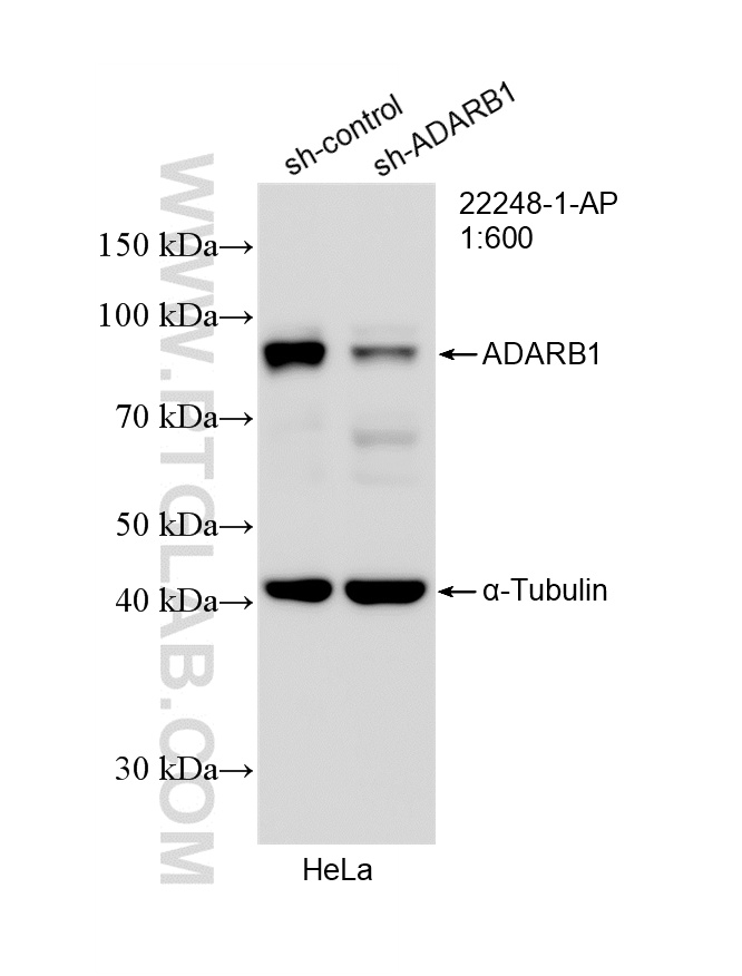 WB analysis of HeLa using 22248-1-AP WB analysis of HeLa using 22248-1-AP