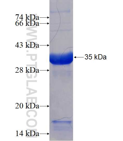 ADARB1 fusion protein Ag17852 SDS-PAGE