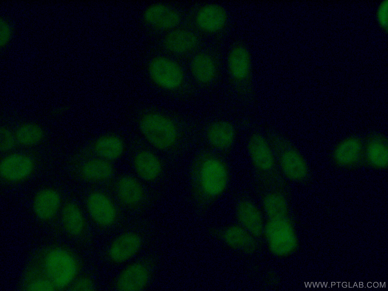 IF Staining of MCF-7 using 15482-1-AP