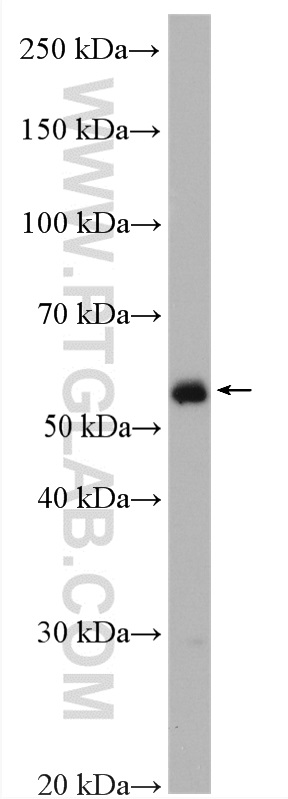 WB analysis of mouse ovary using 15482-1-AP