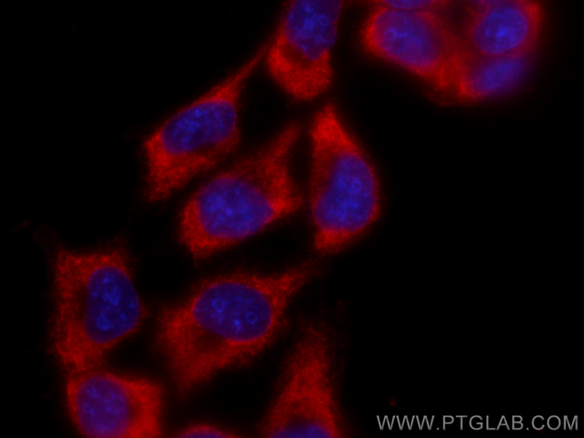 IF Staining of A431 using CL594-67884