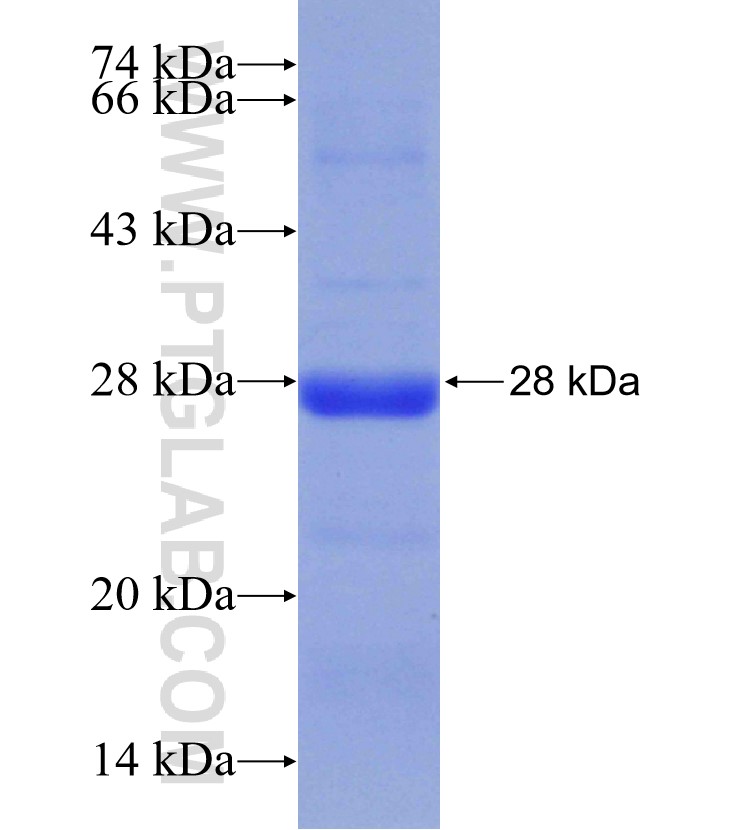 ADC fusion protein Ag31049 SDS-PAGE
