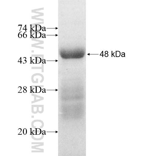ADCK1 fusion protein Ag11850 SDS-PAGE