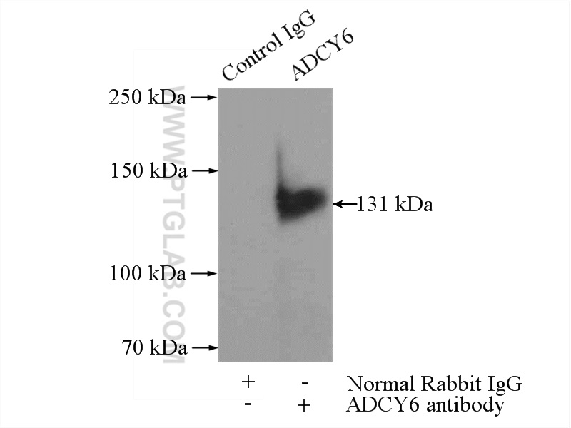 IP experiment of mouse brain using 14616-1-AP