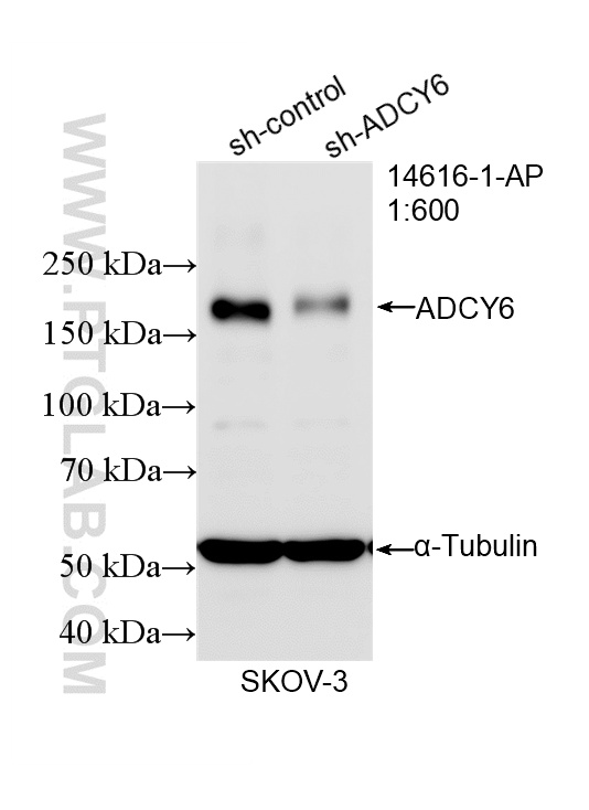 WB analysis of SKOV-3 using 14616-1-AP WB analysis of SKOV-3 using 14616-1-AP