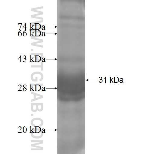 ADCY7 fusion protein Ag4964 SDS-PAGE ADCY7 fusion protein Ag4964 SDS-PAGE