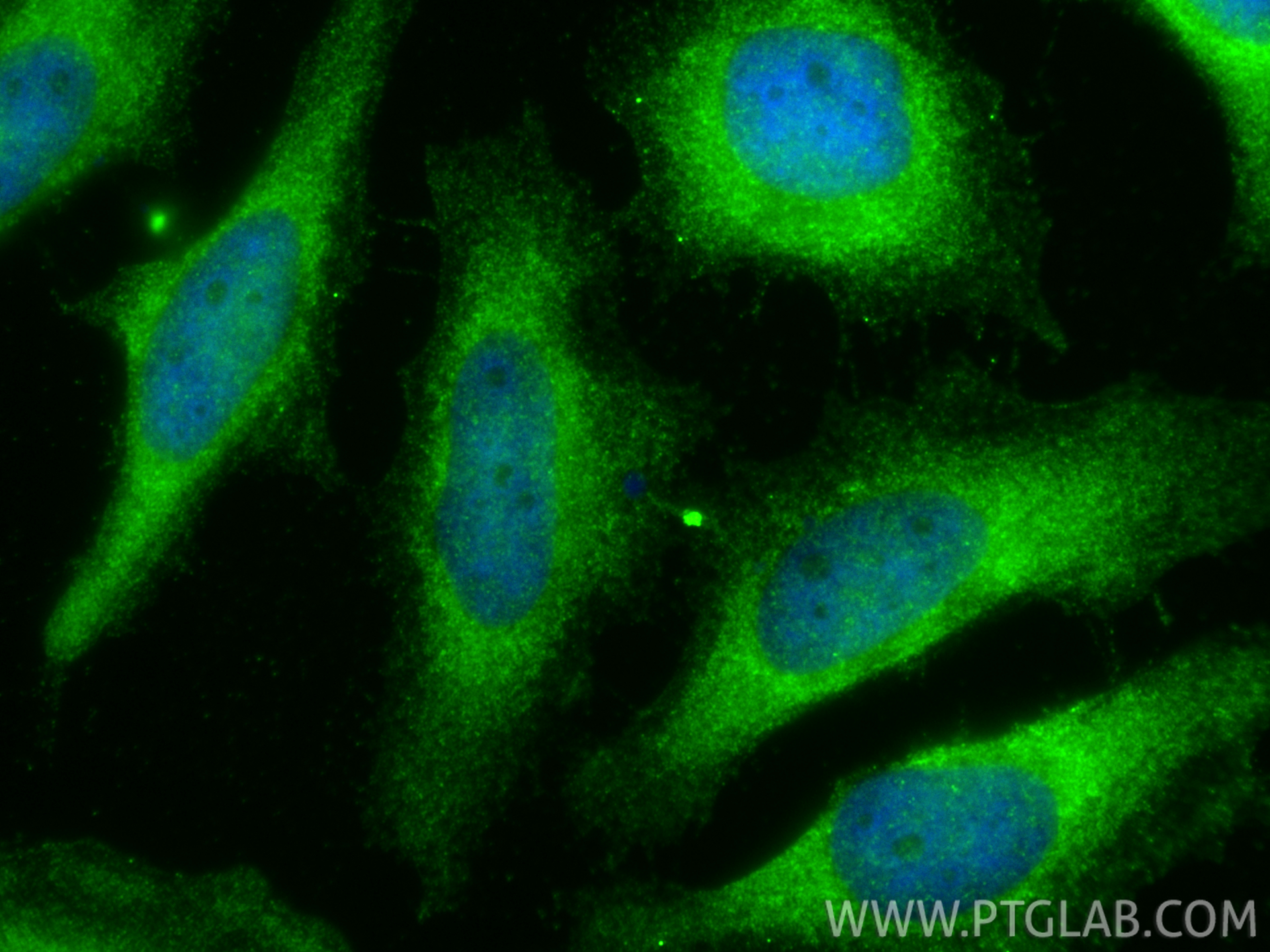 IF Staining of HeLa using 18163-1-AP IF Staining of HeLa using 18163-1-AP