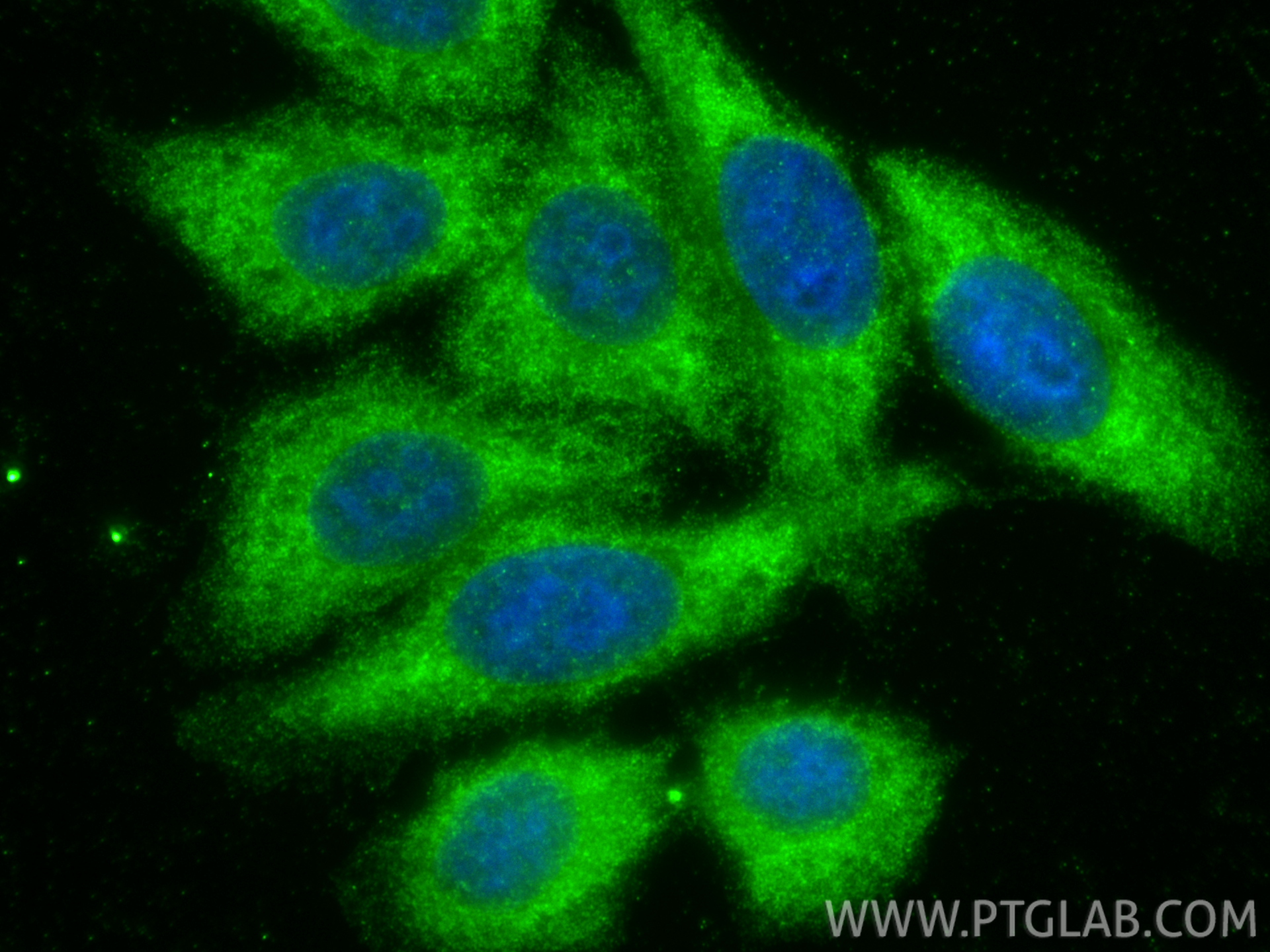 IF Staining of HepG2 using 18163-1-AP IF Staining of HepG2 using 18163-1-AP