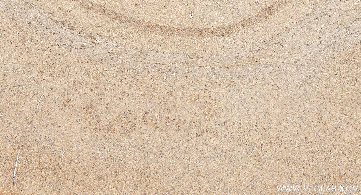 IHC staining of mouse brain using 18163-1-AP IHC staining of mouse brain using 18163-1-AP