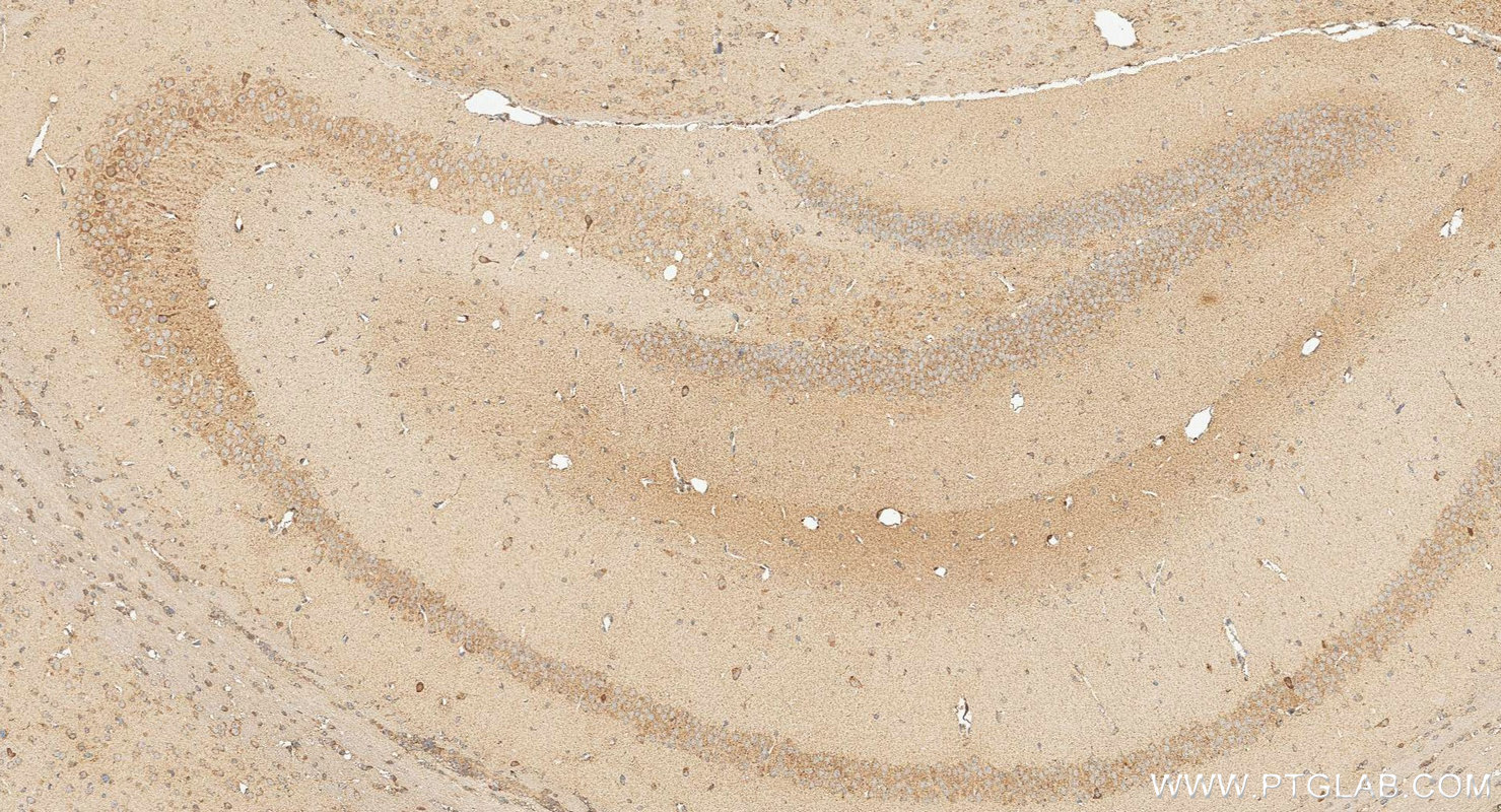 IHC staining of mouse brain using 18163-1-AP IHC staining of mouse brain using 18163-1-AP