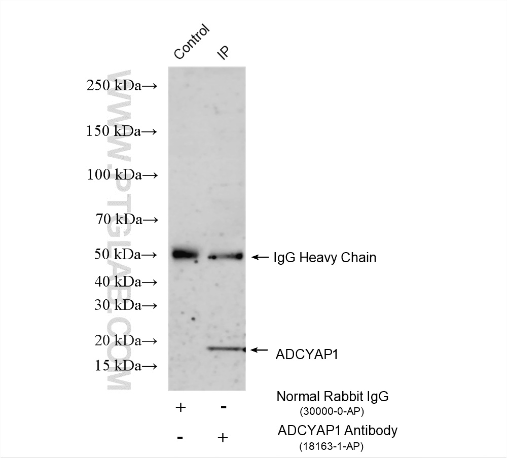IP experiment of HeLa using 18163-1-AP IP experiment of HeLa using 18163-1-AP