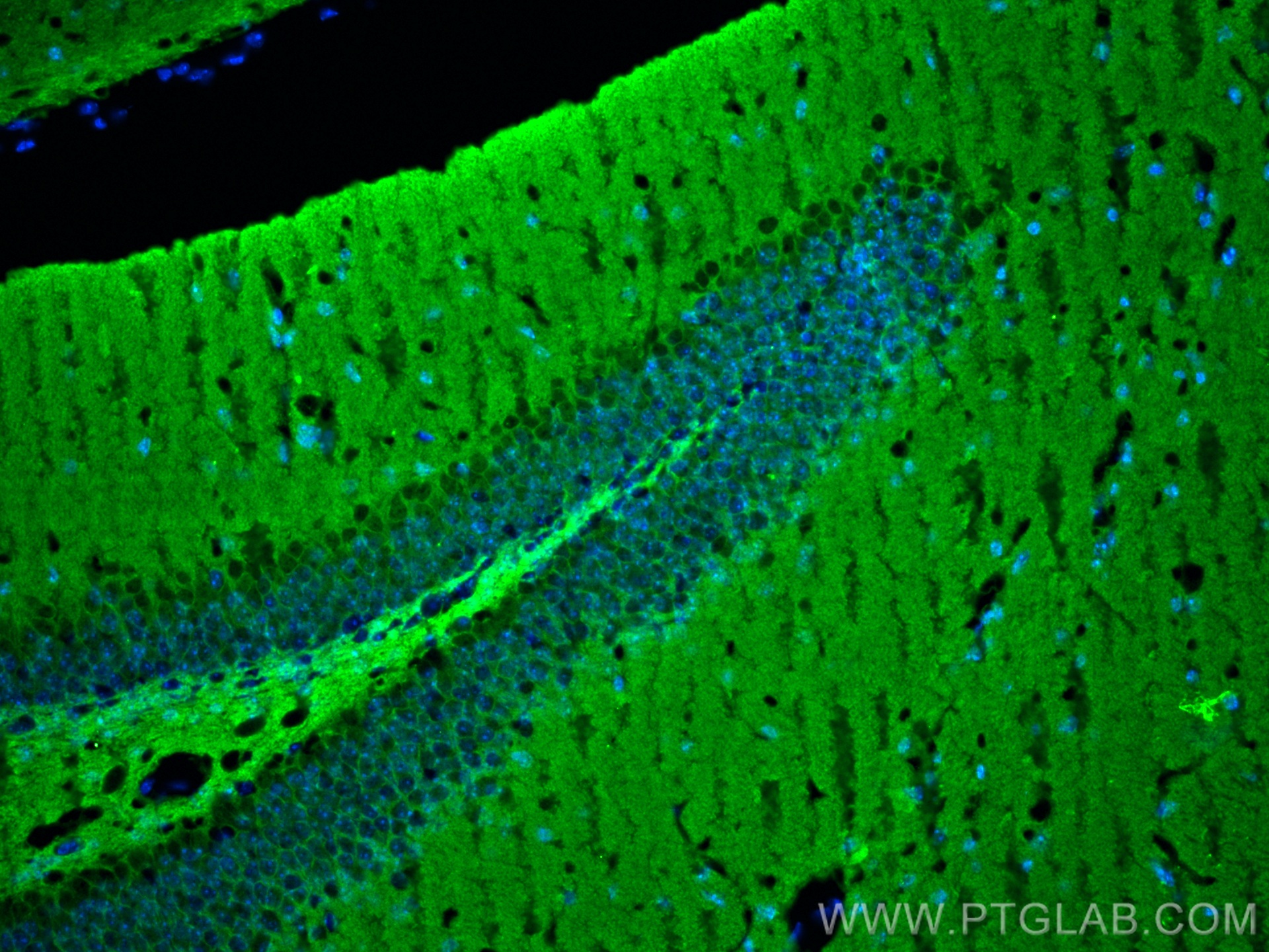 IF Staining of mouse brain using 10791-1-AP