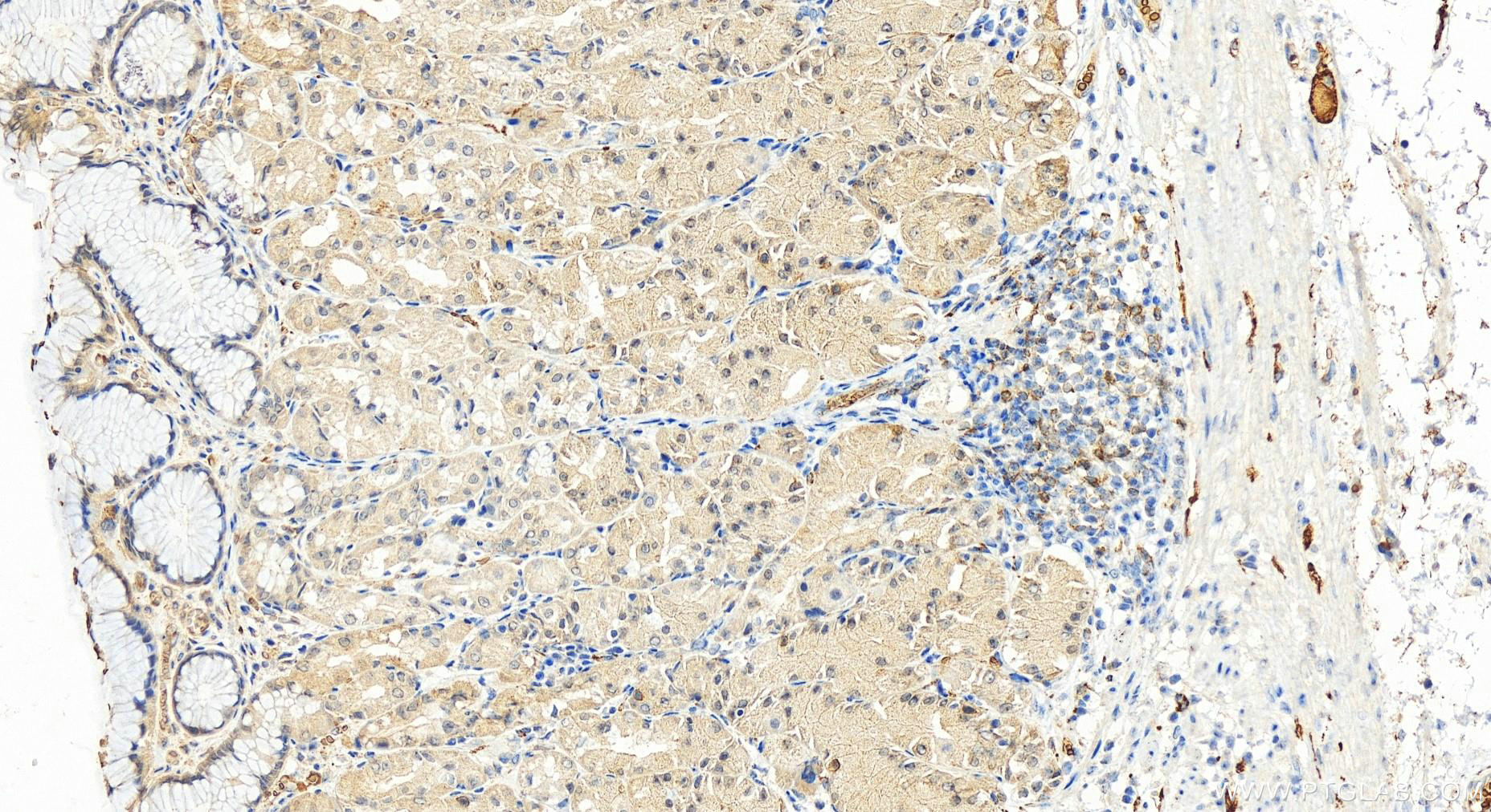 IHC staining of human stomach using 14640-1-AP