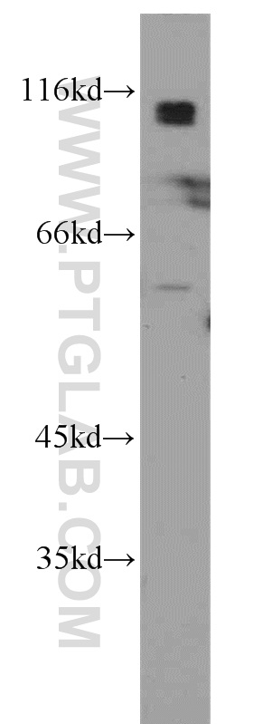 Beta Adducin