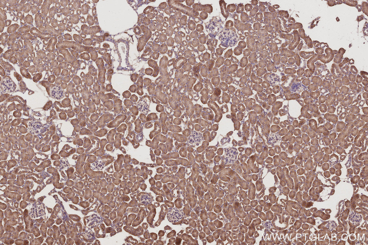 IHC staining of mouse kidney using 17585-1-AP IHC staining of mouse kidney using 17585-1-AP