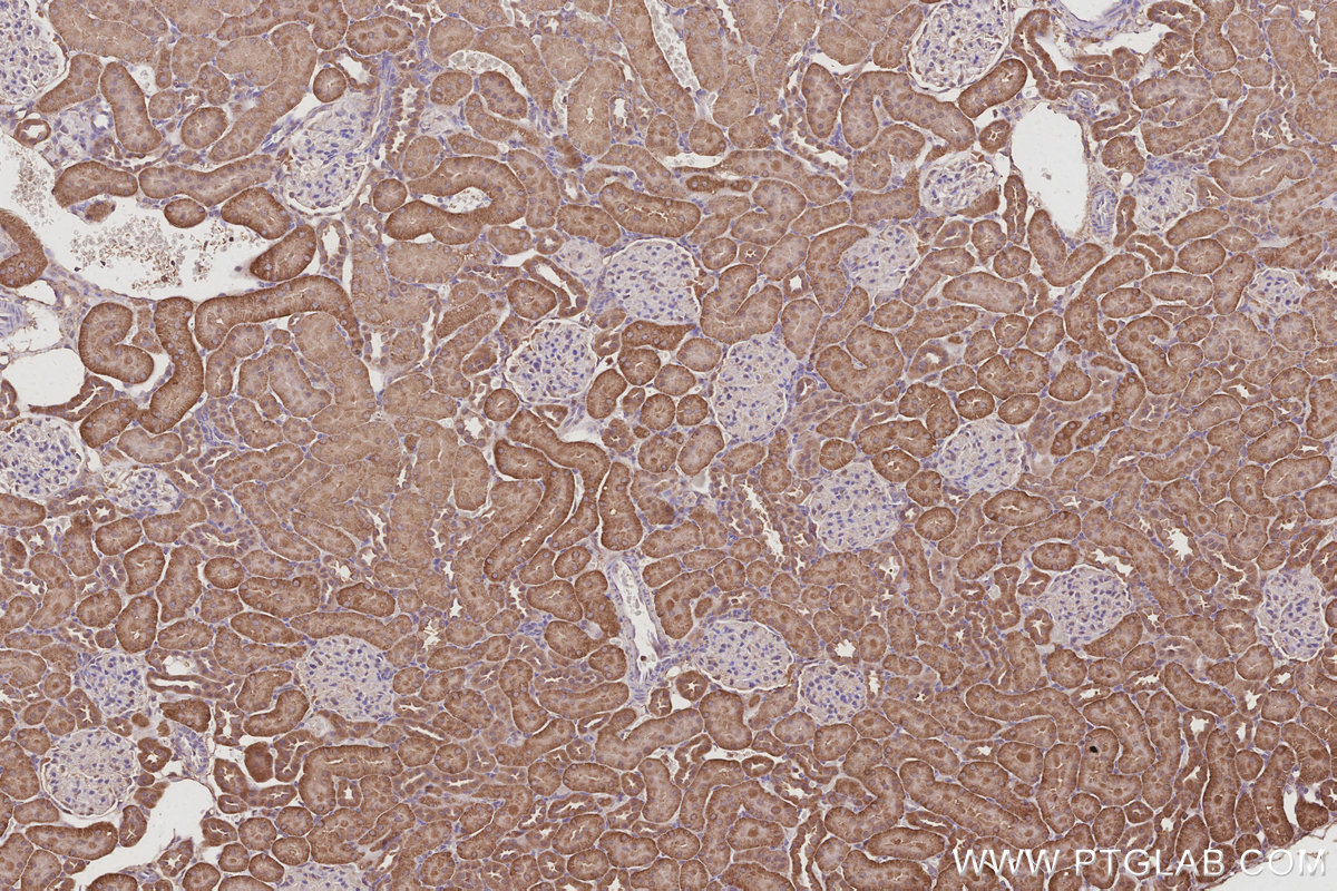 IHC staining of rat kidney using 17585-1-AP IHC staining of rat kidney using 17585-1-AP