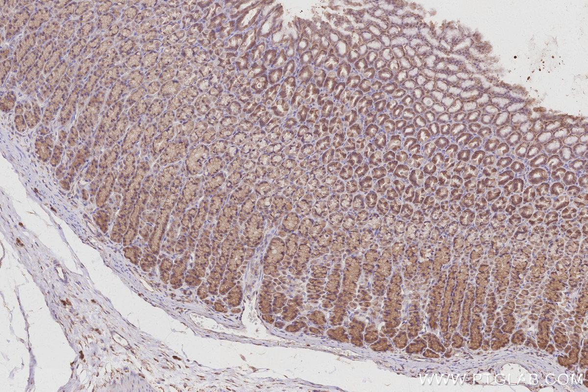 IHC staining of rat stomach using 17585-1-AP IHC staining of rat stomach using 17585-1-AP