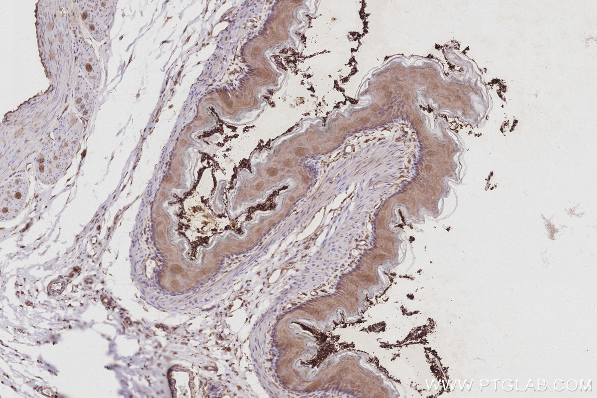 IHC staining of rat stomach using 17585-1-AP IHC staining of rat stomach using 17585-1-AP