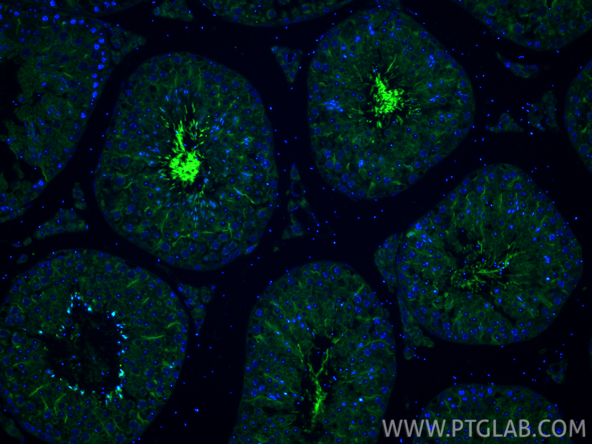 Immunofluorescent analysis of (4% PFA) fixed paraffin-embedded mouse testis tissue using ADGB antibody (31756-1-AP) at dilution of 1:200 and CoraLite®488-Conjugated Goat Anti-Rabbit IgG(H+L) (<a class='green' href='/productredirect?CatalogNo=SA00013-2' target='_blank'>SA00013-2</a>). Heat mediated antigen retrieval with Tris-EDTA buffer (pH 9.0). IF Staining of mouse testis using 31756-1-AP