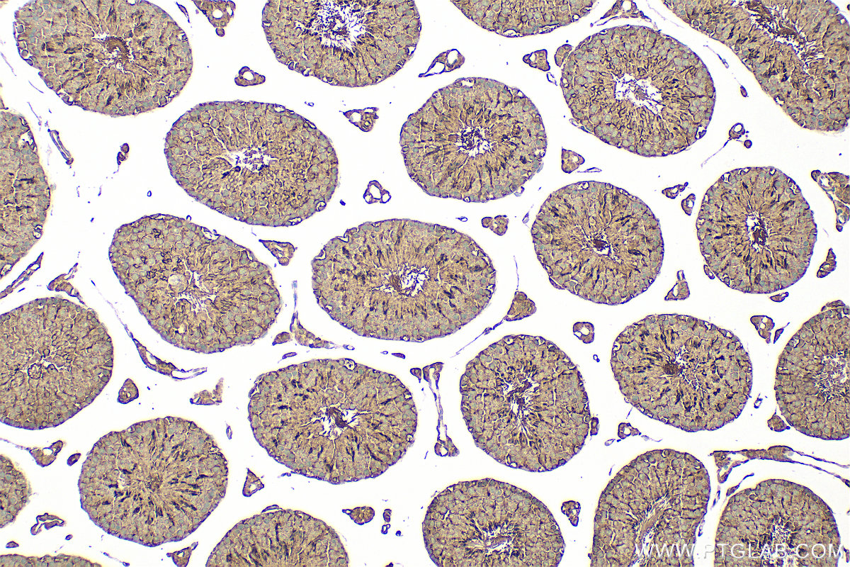 Immunohistochemical analysis of paraffin-embedded mouse testis tissue slide using 31756-1-AP (C6orf103 antibody) at dilution of 1:100 (under 10x lens). Heat mediated antigen retrieval with Tris-EDTA buffer (pH 9.0). IHC staining of mouse testis using 31756-1-AP