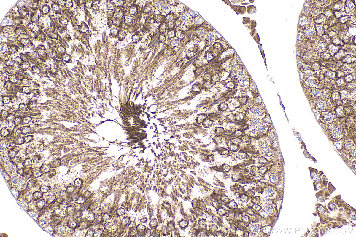 Immunohistochemical analysis of paraffin-embedded rat testis tissue slide using 31756-1-AP (C6orf103 antibody) at dilution of 1:100 (under 40x lens). Heat mediated antigen retrieval with Tris-EDTA buffer (pH 9.0). IHC staining of rat testis using 31756-1-AP