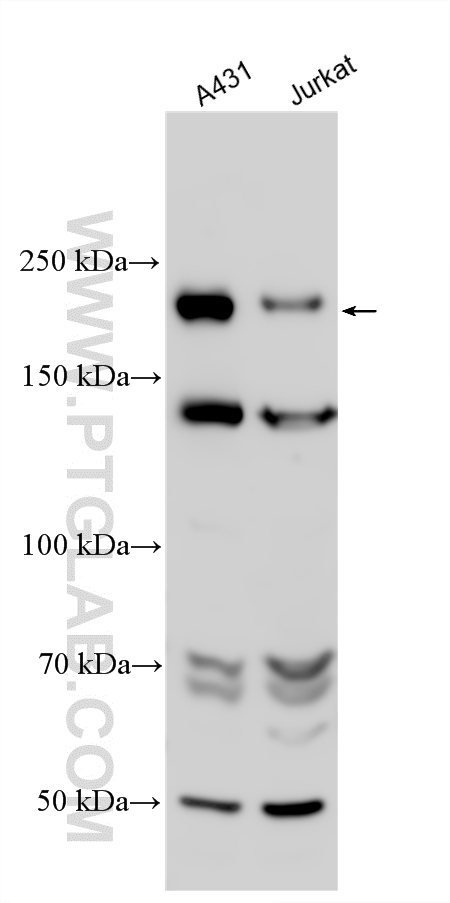 Various lysates were subjected to SDS PAGE followed by western blot with 31756-1-AP (ADGB antibody) at dilution of 1:500 incubated at room temperature for 1.5 hours. WB analysis using 31756-1-AP