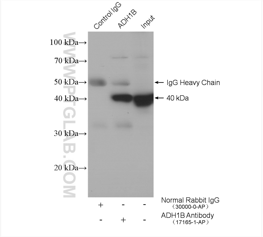 IP experiment of mouse liver using 17165-1-AP