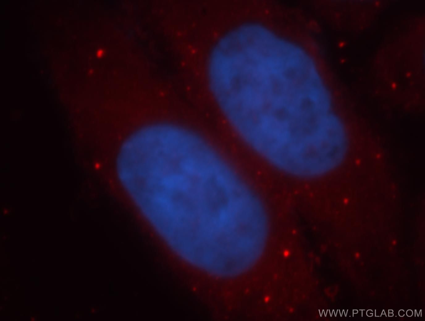 IF Staining of HepG2 using 18897-1-AP