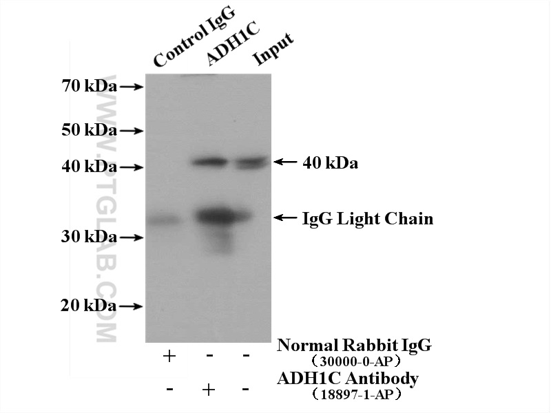 IP experiment of mouse liver using 18897-1-AP