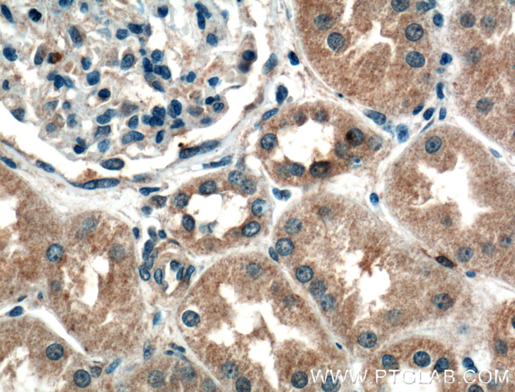 IHC staining of human kidney using 16474-1-AP