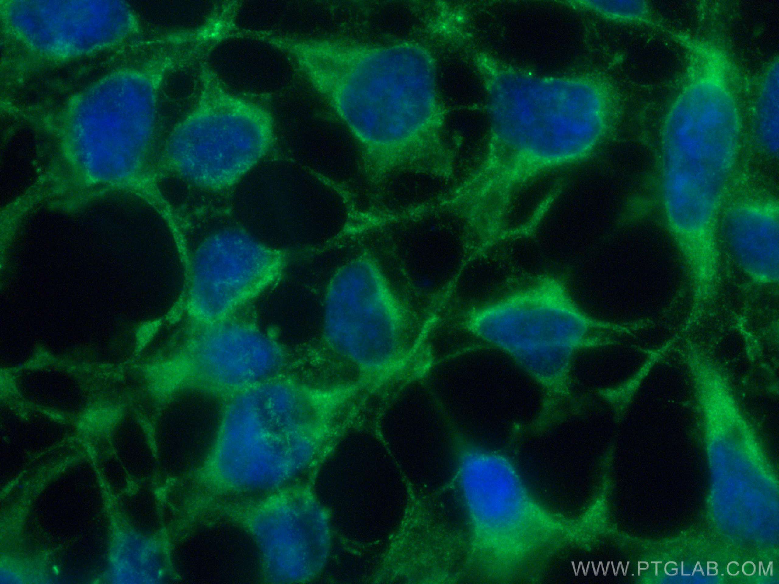 IF Staining of HEK-293 using 67303-1-Ig