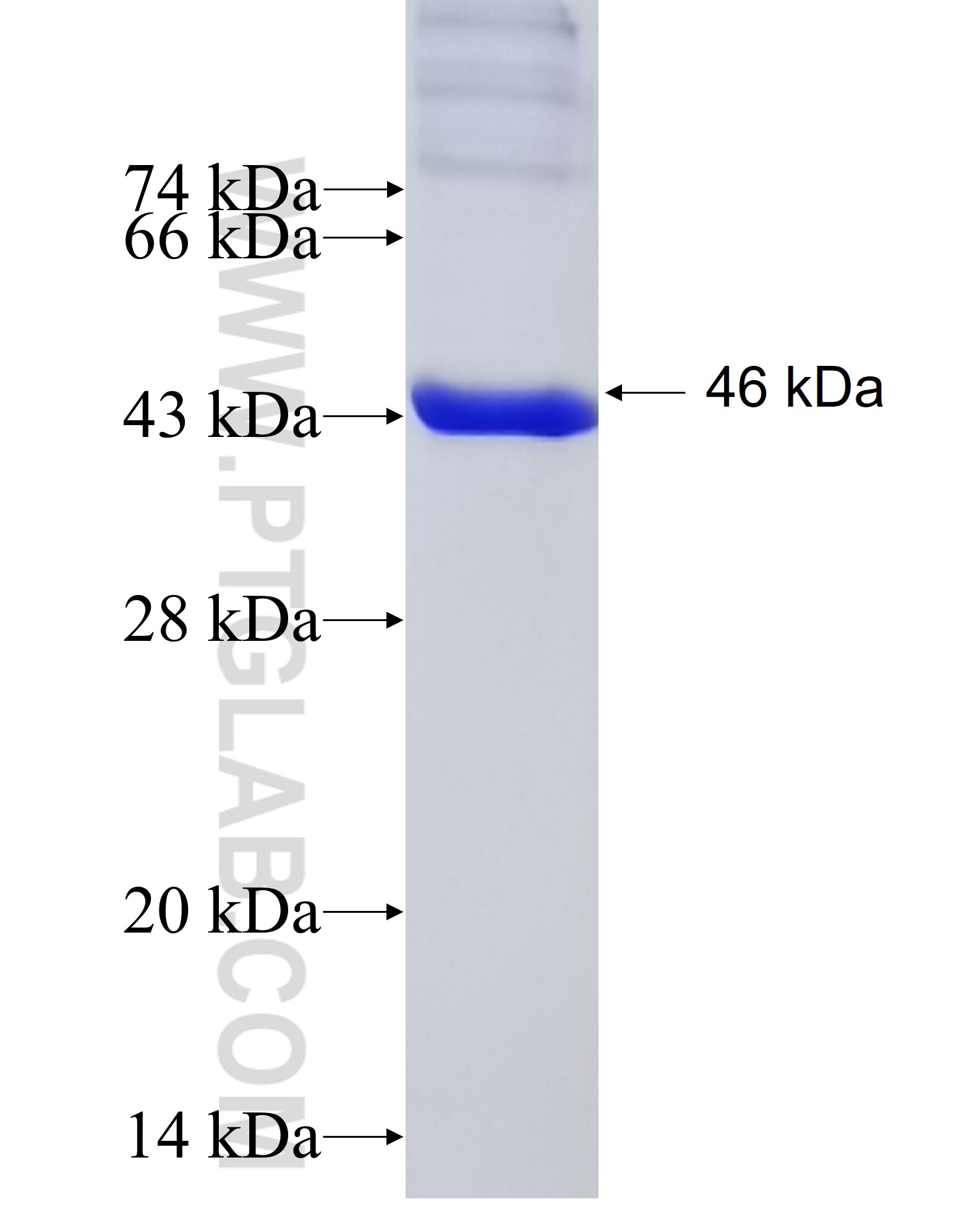 ADH4 fusion protein Ag9884 SDS-PAGE