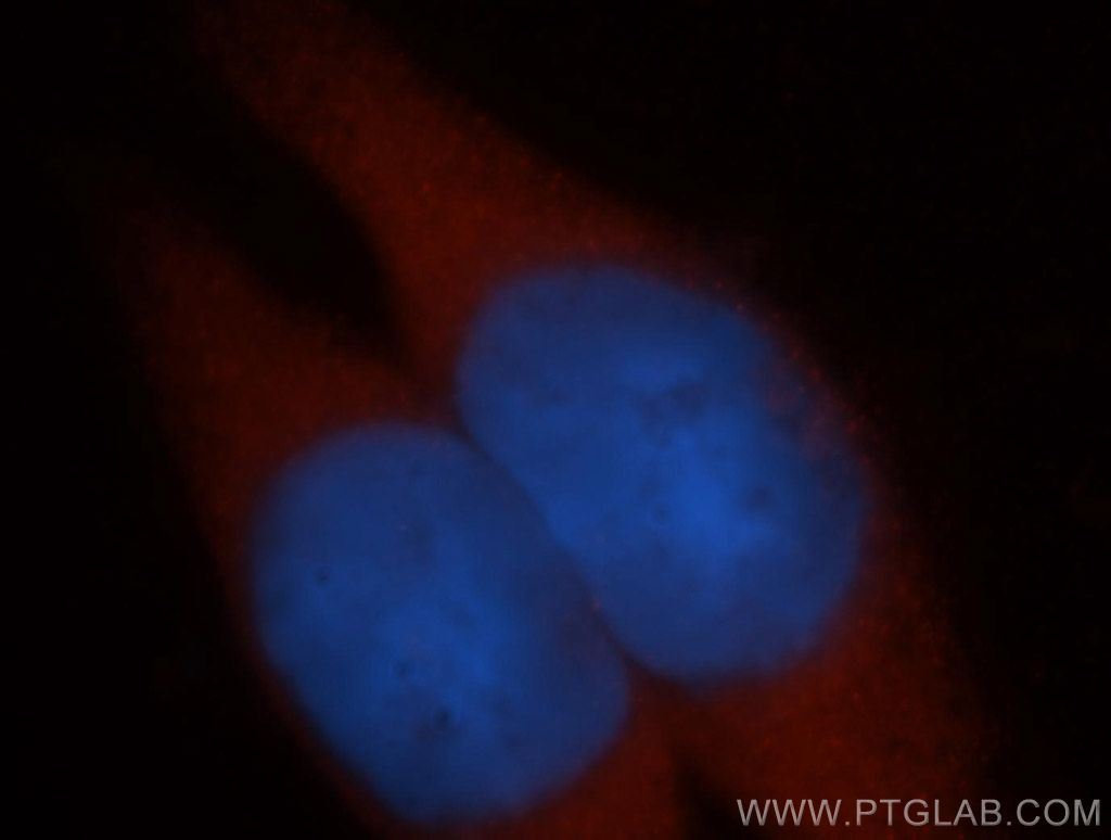 ADH6 Polyclonal antibody