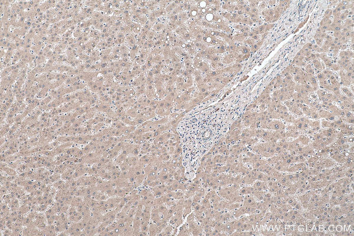 IHC staining of human liver using 13288-2-AP