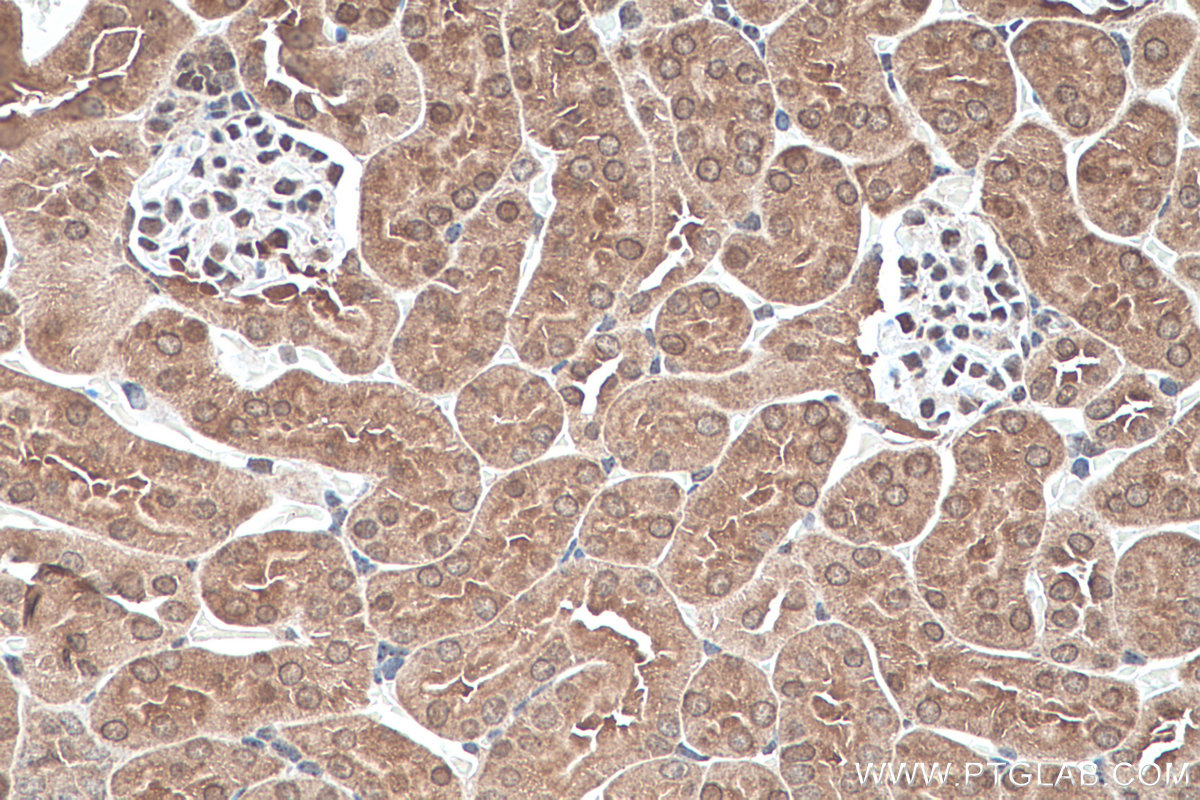 IHC staining of mouse kidney using 13288-2-AP